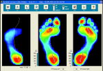 gaitscan